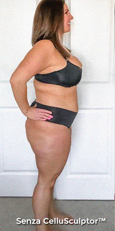 Before - Isabelle