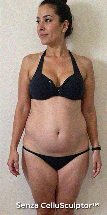 Before - Sophia