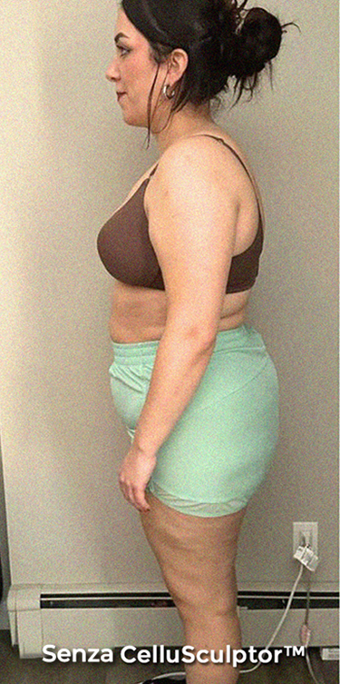 Before - Laura