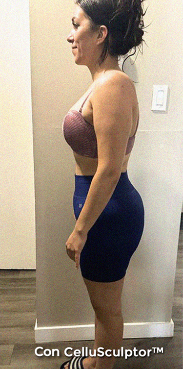After - Laura